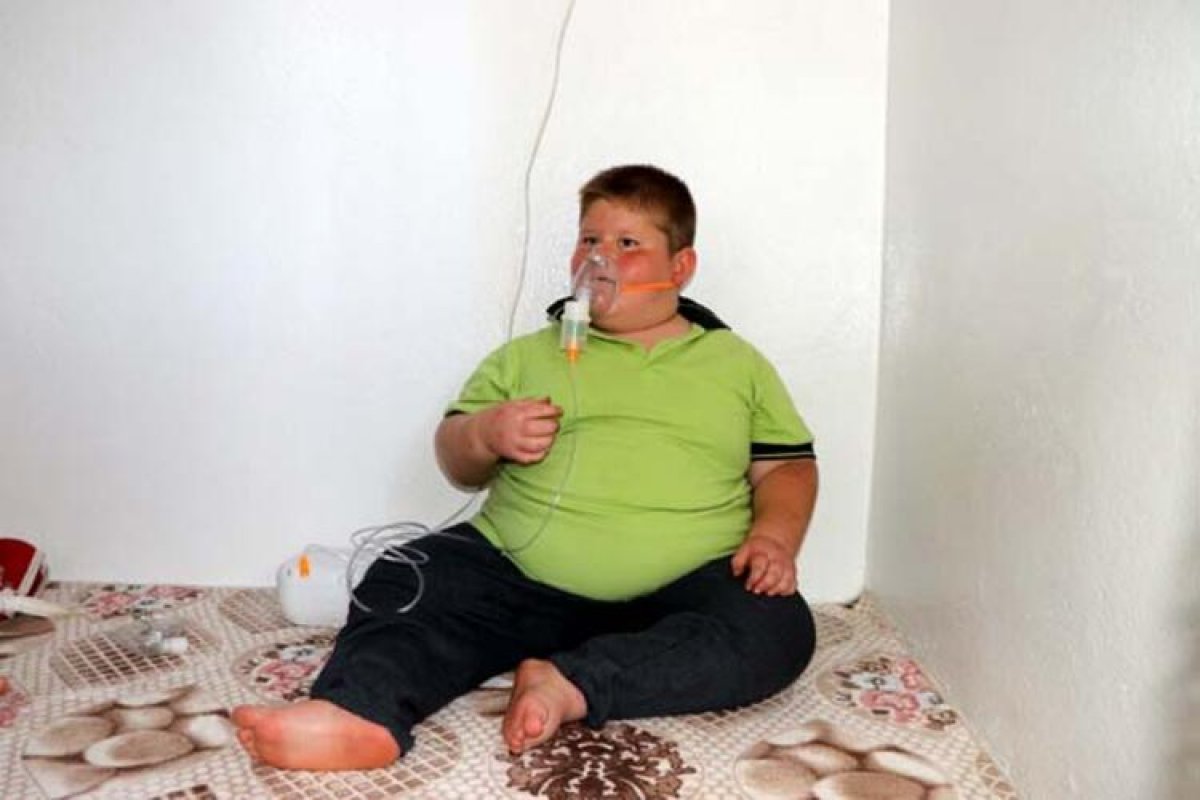 Gaziantep te Prader Willi sendromlu küçük Mustafa, yardım bekliyor #6