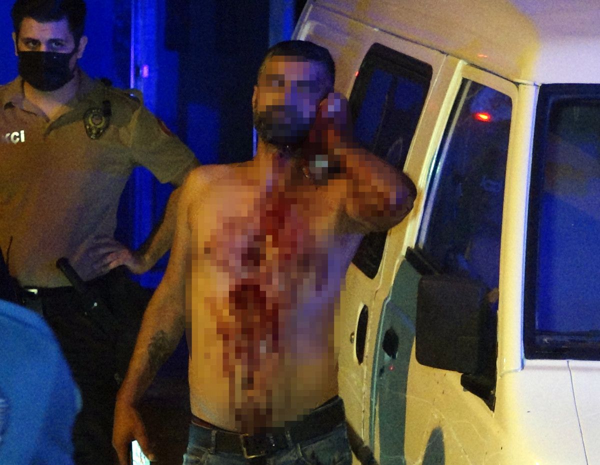 Antalya da aralarında husumet olan şahıslar birbirlerini yaraladı #4