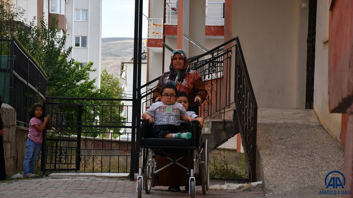 Sivas ta cam kemik hastası ikizlere tekerlekli sandalye üretildi #4