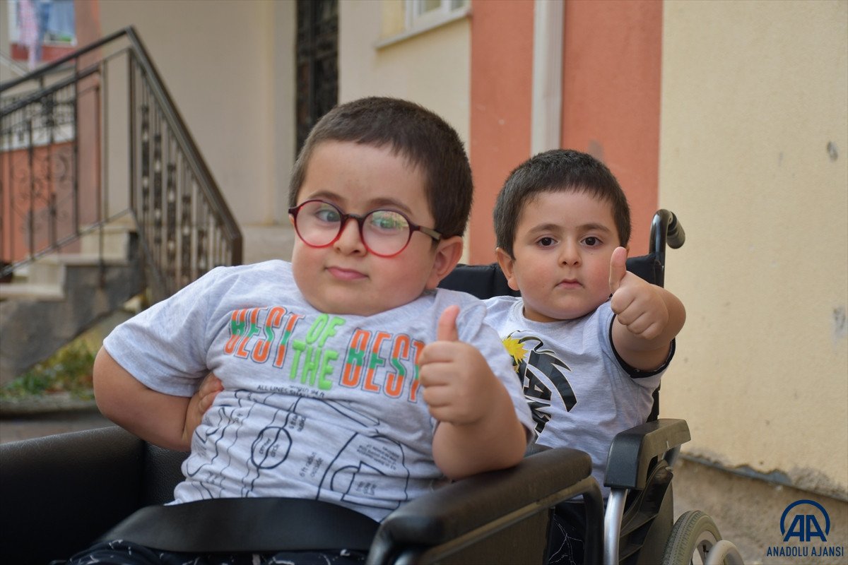 Sivas ta cam kemik hastası ikizlere tekerlekli sandalye üretildi #2