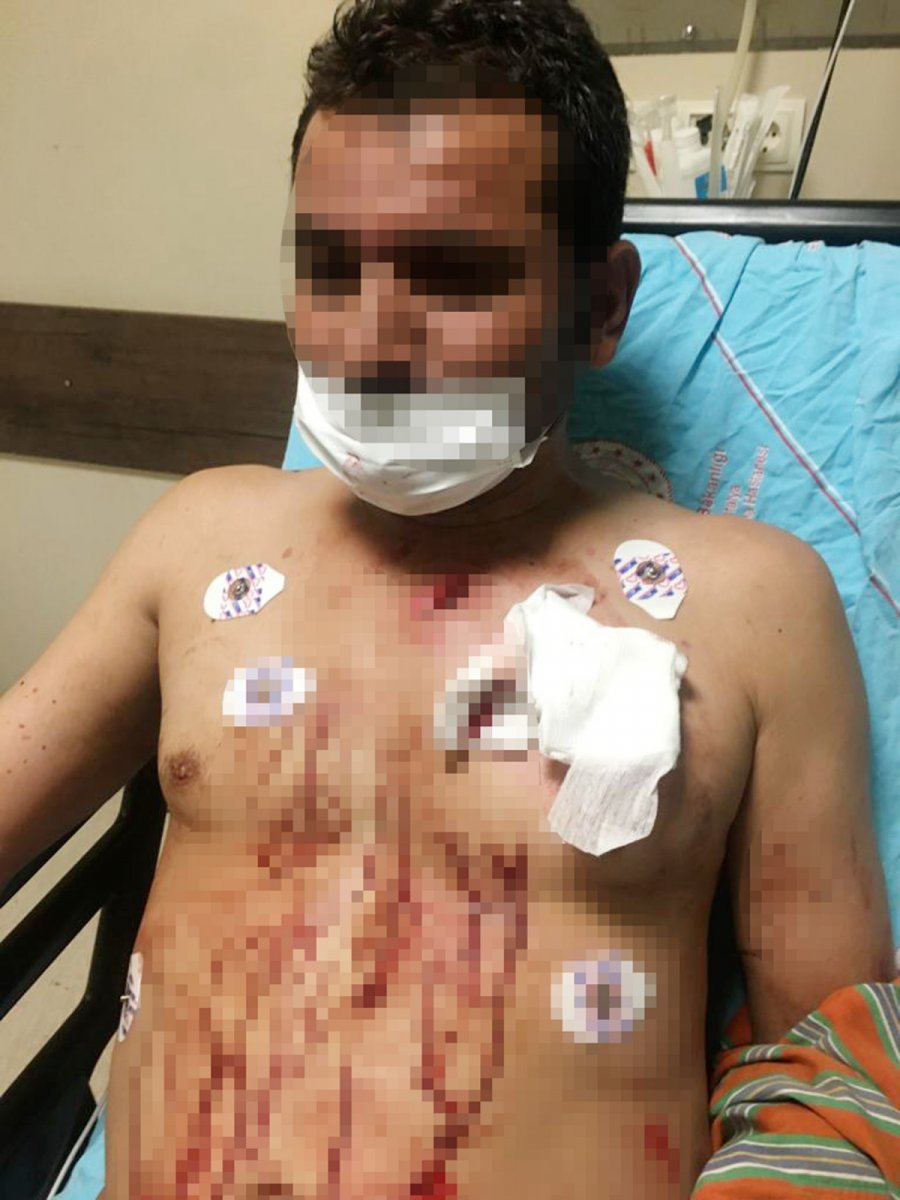 Antalya da uygunsuz fotoğraflarını paylaşan erkek arkadaşını bıçakladı #1