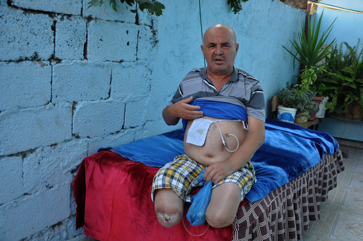 Gaziantep’te, ayakları kesilen adamın akülü sandalye çağrısı #5