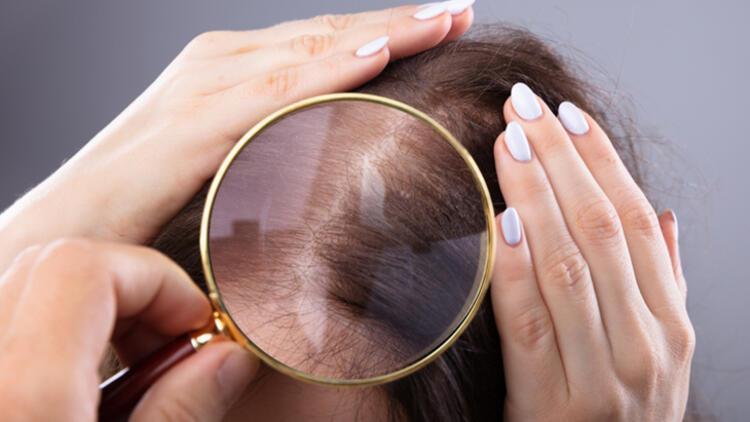 Saç dökülmesinden nasıl kurtulabilirsiniz
