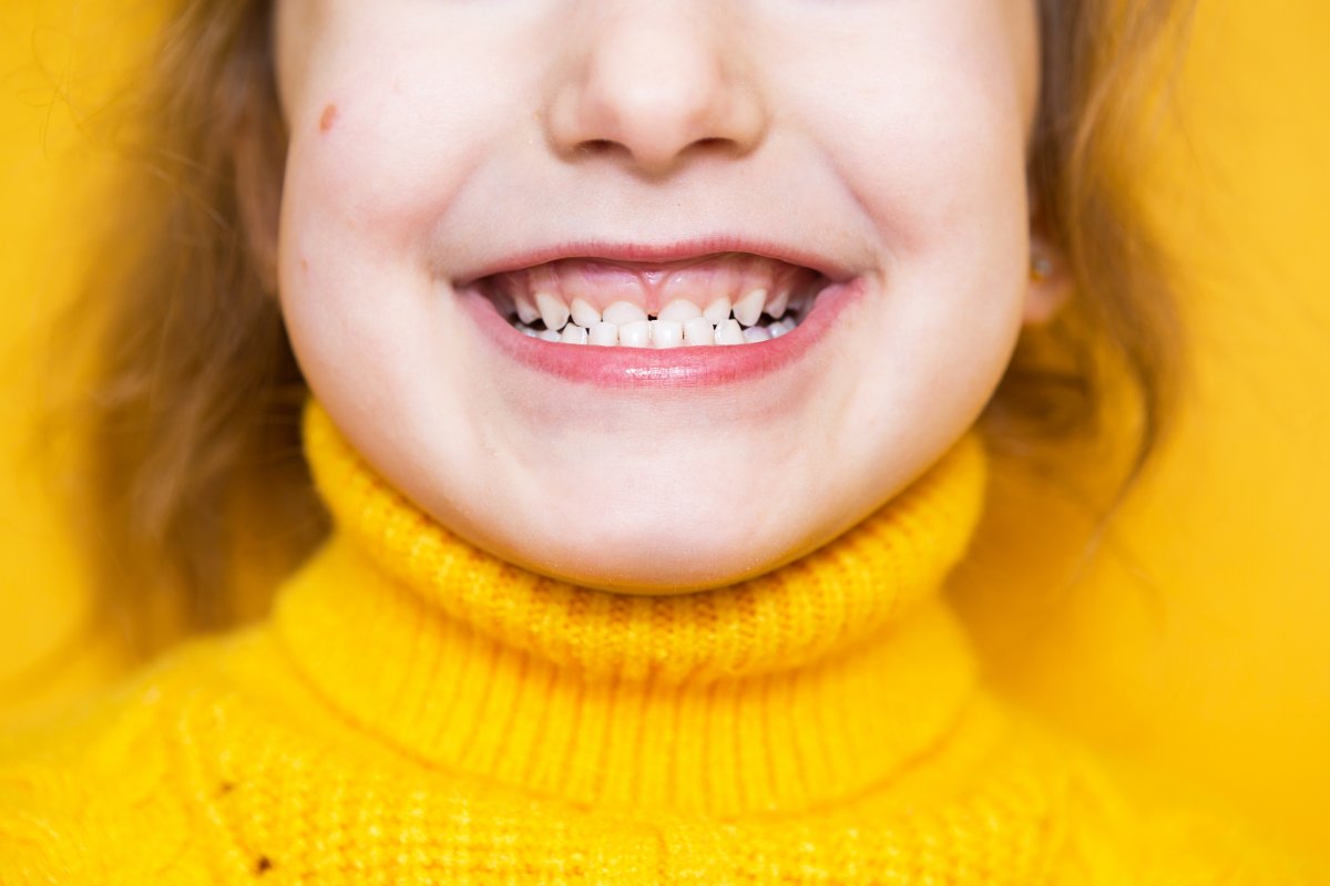 Çocukların uykuda diş gıcırdatmasının 4 ana nedeni #2
