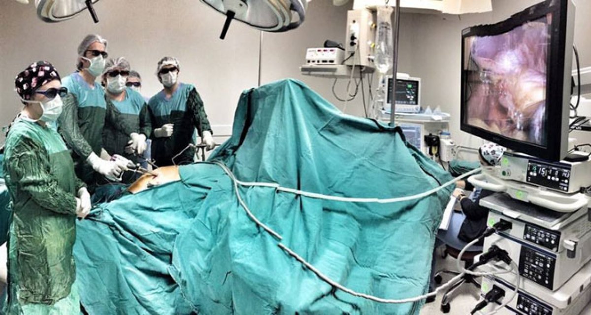 Daha az ağrıyla ameliyat olma yöntemi: Laparoskopik Cerrahi