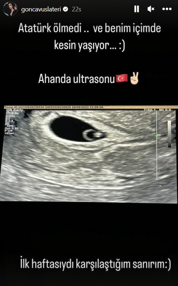 Gonca Vuslateri, bebeğinin ultrason görüntüsünü yayınladı